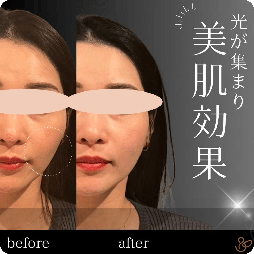 施術前後を比較した写真：美肌効果