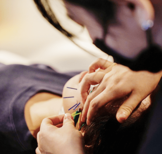 施術をしている鍼灸師の手元