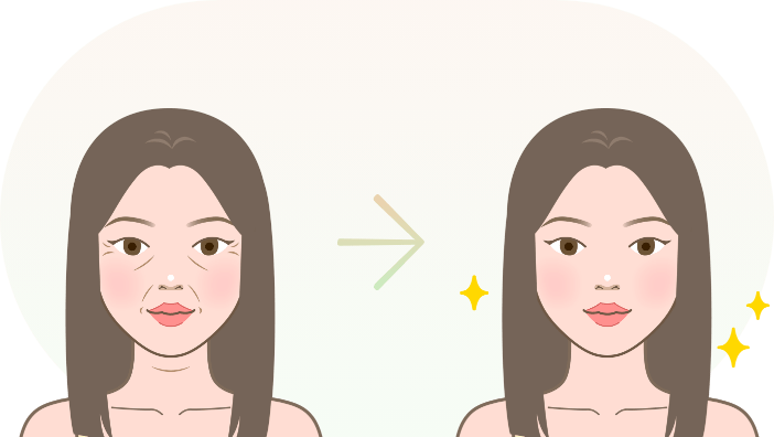 たるみ・シワが改善された女性のビフォーアフター