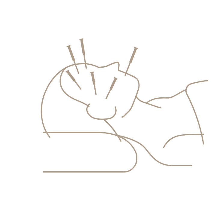 小顔鍼メニューのイラスト