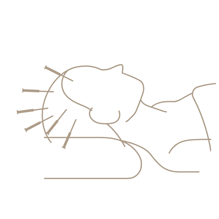 育毛鍼メニューのイラスト