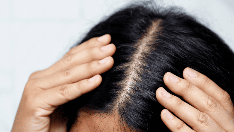 分け目を気にしている様子