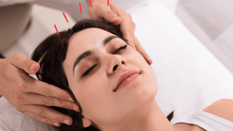 育毛鍼の施術を受けている女性