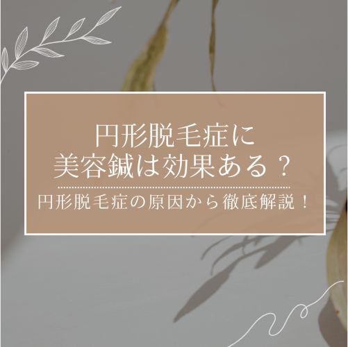 円形脱毛症に美容鍼は効果ある？円形脱毛症の原因から徹底解説！