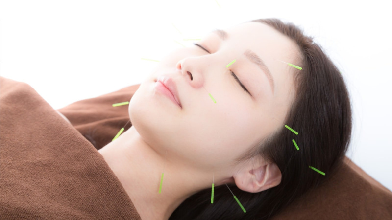 美容鍼をする女性